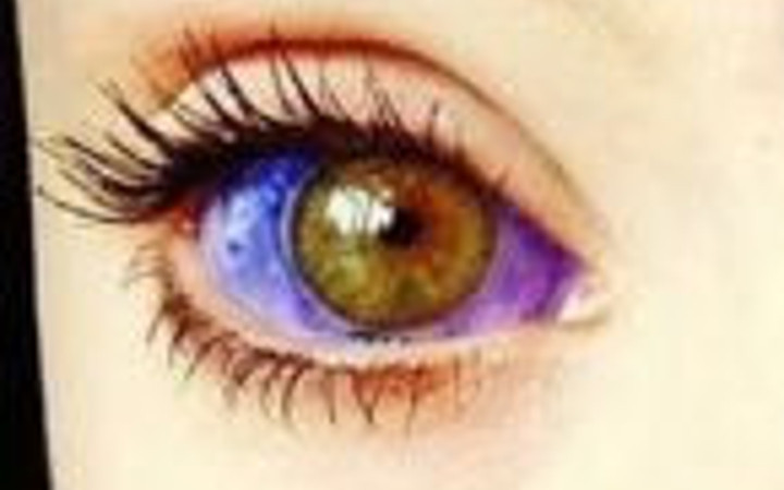 Gözlerine dövme yaptıran çılgınlar