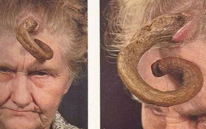 Dünyanın en tuhaf hastalıkları