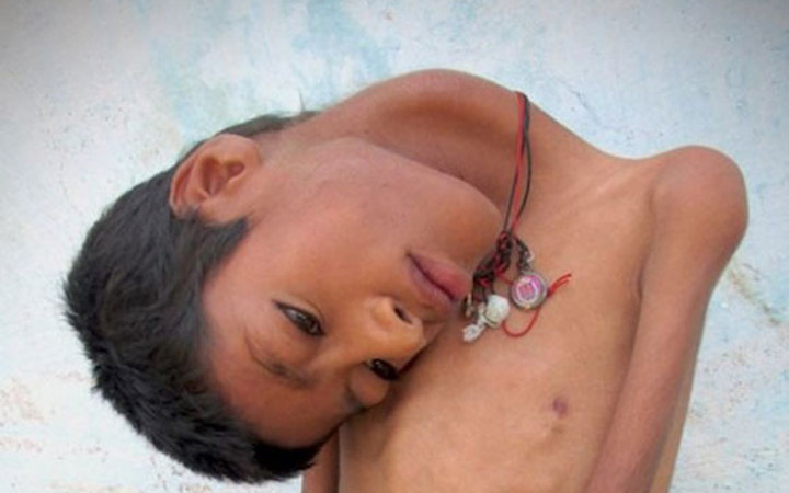 12 yıldır başını kaldıramıyor