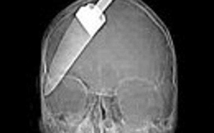 İnanılmaz röntgen filmleri