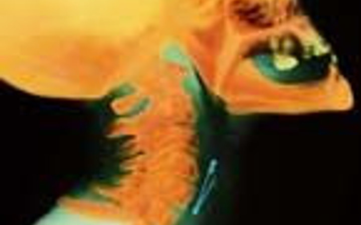 Bu röntgenler gerçek!