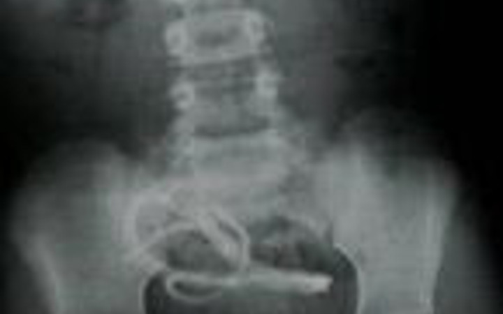 Türklere nasip ölümler