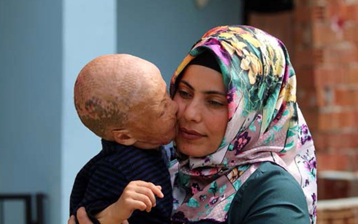 Aydın'da yaşayan Halil Geyik'in ameliyatı için gerekli para toplandı