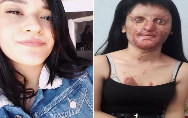 Berfin Özek tanınmaz hale geldi babası ilk kez konuştu