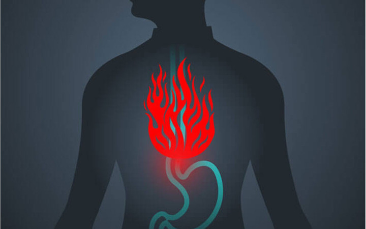 Reflüsü olanlar dikkat! Uzmanından uyarılar ve tavsiyeler