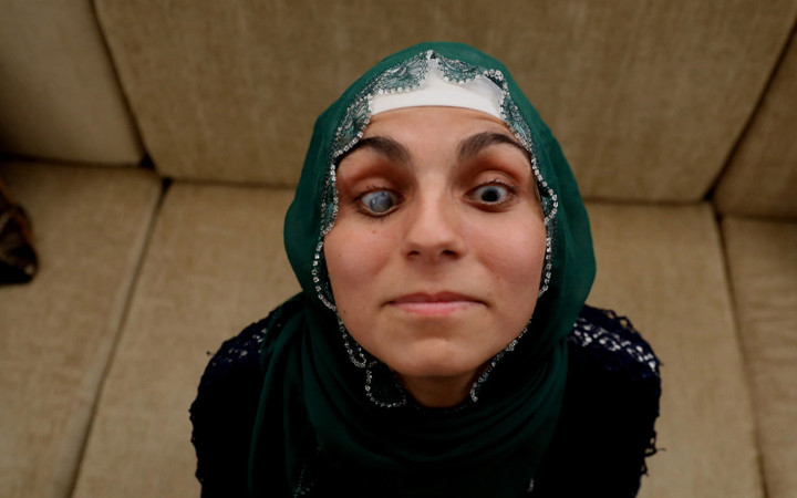 21 yaşındaki Ayşe Acar kendini ilk kez aynada gördü