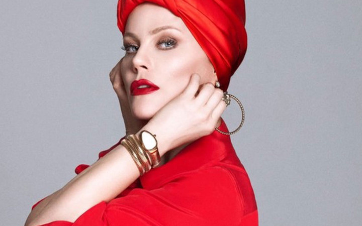 "Seksi Şempanze" olarak ünlenen Yıldız Kaplan'ın son hali şaşırttı!