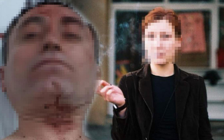 Sevgili dehşeti! Erkek arkadaşının kafasında içki şişesi kırıp, karnından bıçakladı