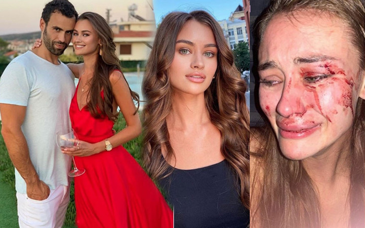Daria Kyryliuk'un Çeşme'deki dayak olayının sebebi para çıktı sevgilisi anlattı