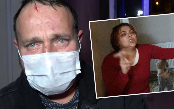 Bursa'da karısı tarafından oklavayla dövülen adam kolu ısırılıp sokağa atıldı