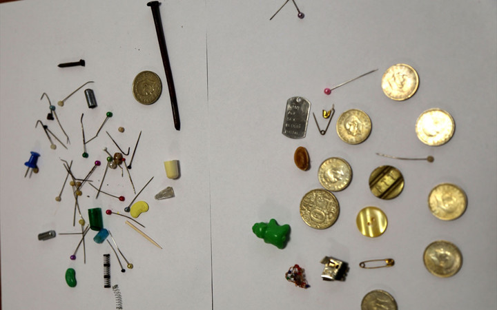 Göğüs cerrahı Ekber Şahin, yanlışlıkla yutulan cisimlerden koleksiyon yaptı! Hepsini ameliyatla çıkardı