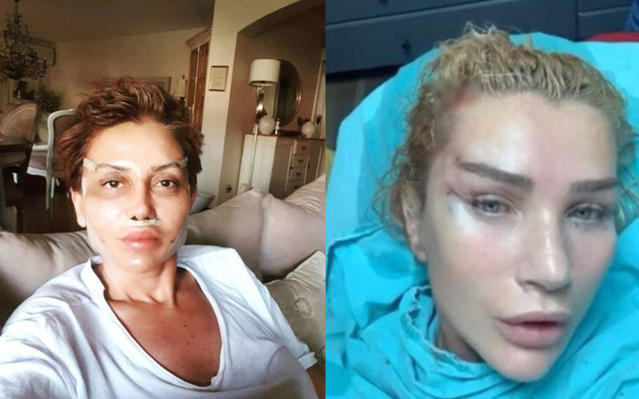 Seda Sayan estetiği yaptıran Serap Paköz'ü kızdırdılar: Beleşçi değilim!