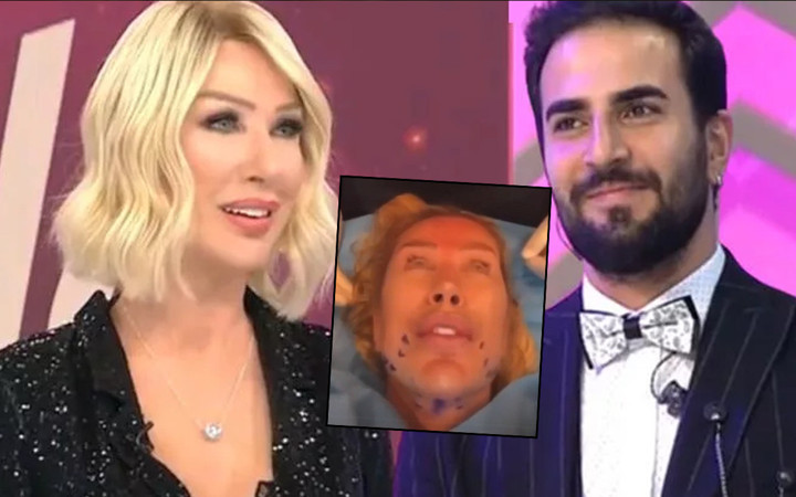 25 yaş küçük aşkı için yüzünü gerdiren Seda Sayan'ı gören tanıyamadı! Çağlar Ökten için bambaşka birine dönüştü