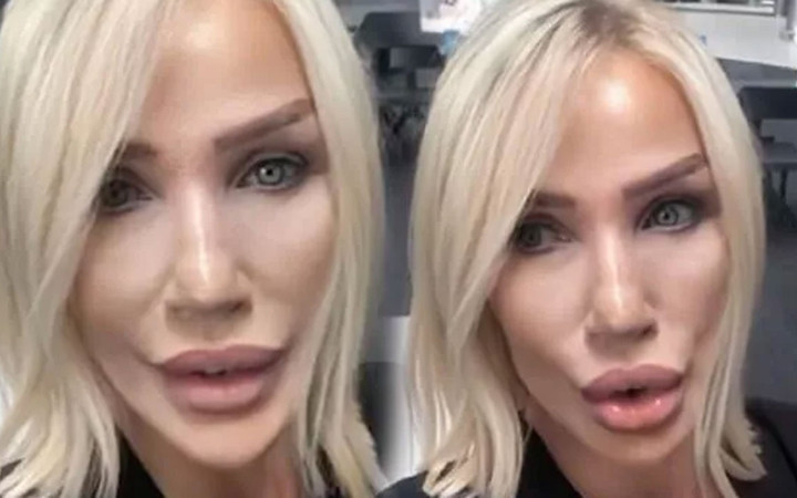 Seda Sayan yine estetik yaptırdı! Yeni halini görenler tanıyamadı 'Kendine ne yaptın?'