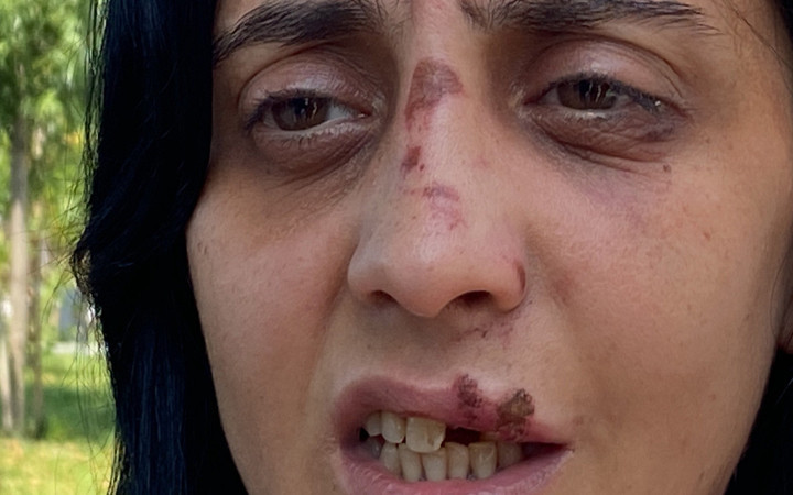 Zonguldak'ta genç kadın iş çıkışı dehşeti yaşadı! Neye uğradığını şaşırdı korkunç!