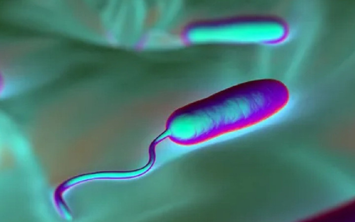 Avrupa'da görülmüştü! Vibrio bakterisi Türkiye'de de ortaya çıktı...