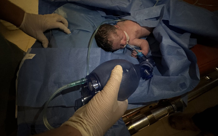 Katliam kan dondurmaya devam ediyor! Saldırıda ölen hamile kadının bebeği kurtarıldı