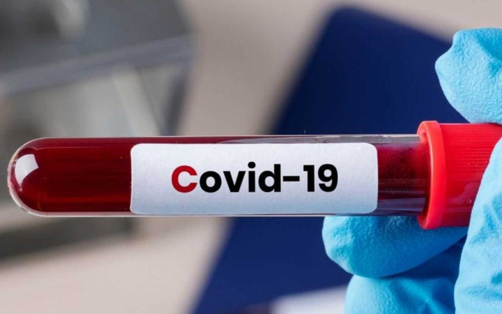 Yeniden kapanma mı geliyor! Uzman isimden korkutan sözler