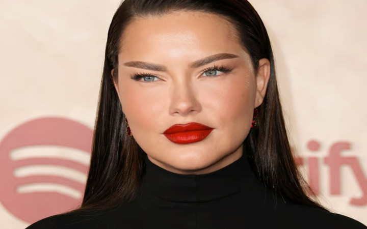Adriana Lima estetik yaptırdı, kimse onu tanıyamadı! Önceki halinden eser yok