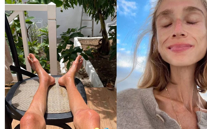 22 kiloya kadar düşmüştü! Sosyal medya fenomeni kaldığı otelde hayatını kaybetti