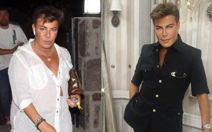 Fatih Ürek'e gerçekte ne oldu? Entübe edilmişti kalp krizinin sebebi için şok iddia