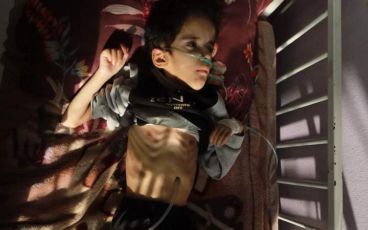 Gazze'de açlık can alıyor! Filistinli çocuklar yaşam mücadelesi veriyor