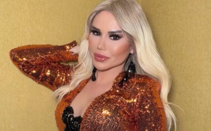 Ceylan'dan estetik itirafı: "Yüzüm kaldırmıyor"