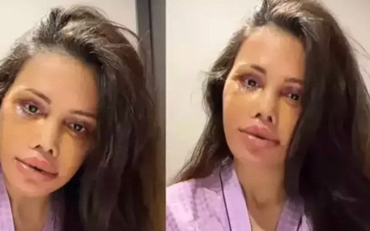 Didem Ceran sağlık durumunu açıkladı! Meğer o hastalıkla mücadele ediyormuş...