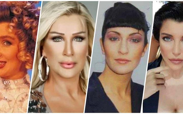 Estetik onlar için mucize oldu! Estetikle adeta yeniden doğan ünlüler...