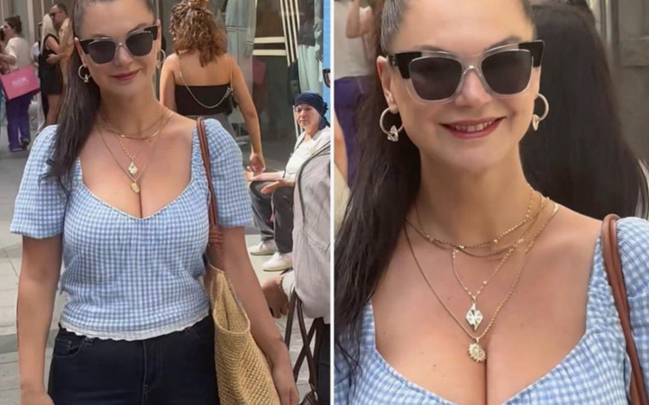 Ortalıkta görünmüyordu! Nez'den estetik açıklaması