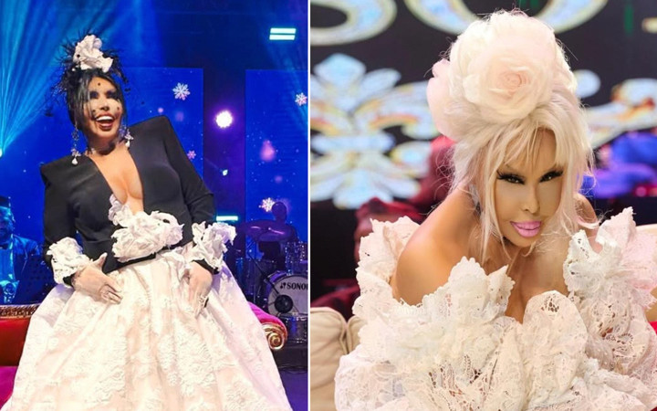 74 yaşındaki Bülent Ersoy'a 'Lolita' operasyonu! Hastane odasından paylaşım yaptı