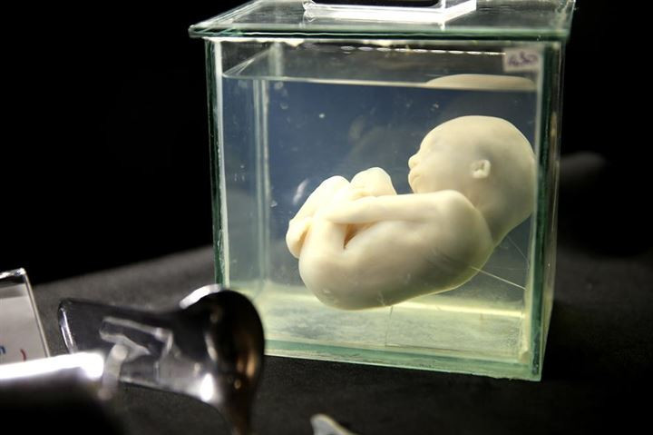 Osmanlı dönemi şifa müzesi açıldı - Resim: 2