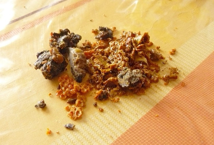 Bilimsel olarak kanıtlandı grip ve dudak uçuklarına karşı bire bir - Resim: 3