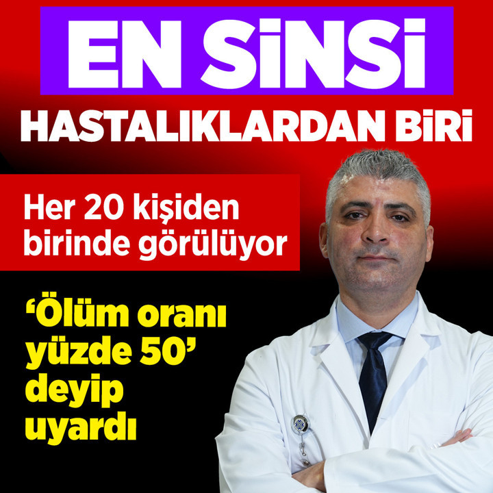 Beyin anevrizması her 20 kişiden birinde görülebilir