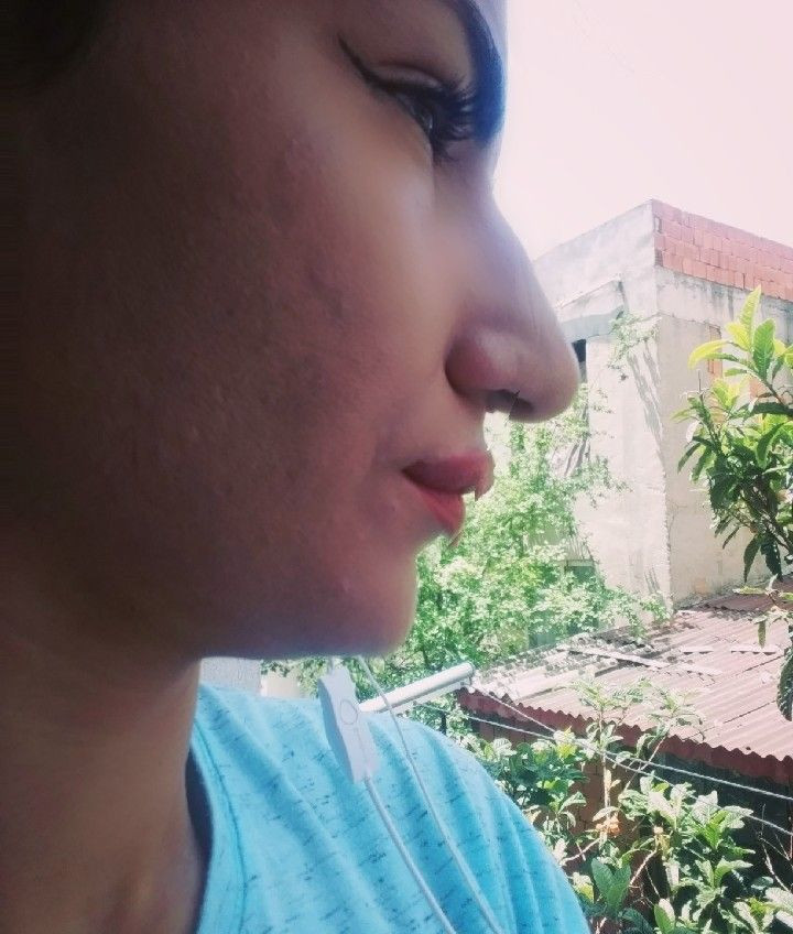 Esenyurt'ta burun estetiği kabusu olan kadının çocuğu: Anne senin burnun yamuk - Resim: 3