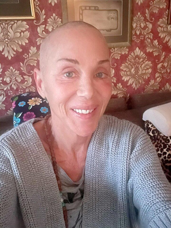 Acı haberle dünyası başına yıkıldı! Kansere yakalanan Billur Kalkavan duyurdu: Benden birçok pisliği aldı - Resim: 3