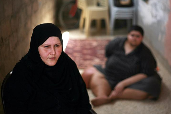 400 kilo olan genç yardım bekliyor - Resim: 2