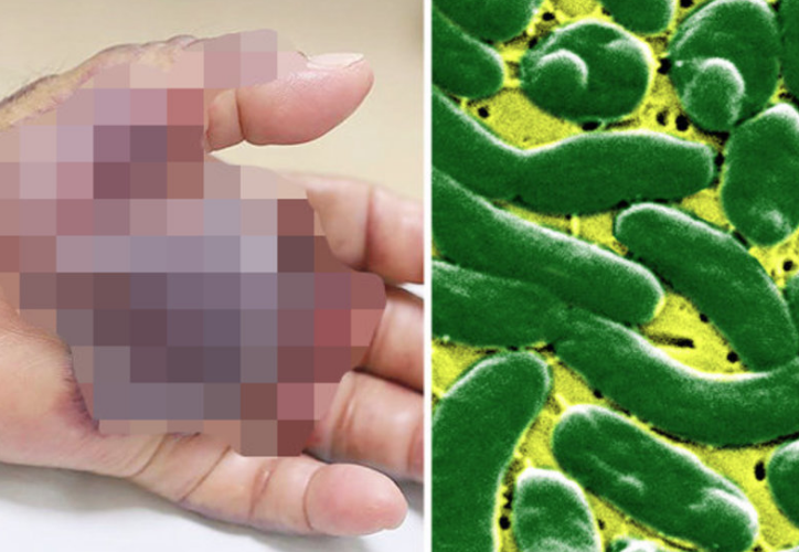 Yediği şey yüzünden eli bu hale geldi ardından kesildi - Resim: 4