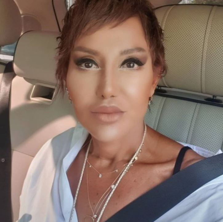 Serap Paköz 'estetikten konuşamıyor' haberlerine ateş püskürdü: Diş çektirdim! - Resim: 4