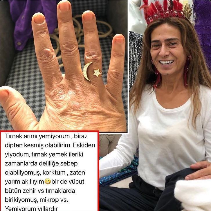 Yıldız Tilbe yüzük gösterirken yakalandı 'Tırnaklarını mı yiyorsun' - Resim: 1