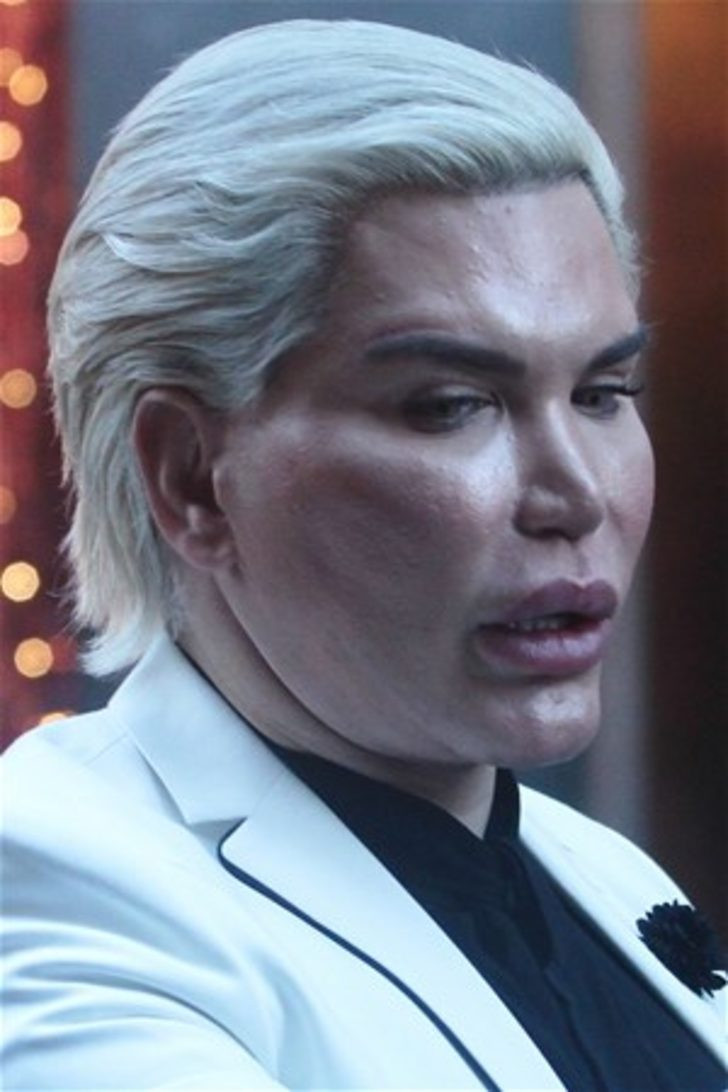 Rodrigo Alves bu sefer Brezilya kalçası yaptırdı - Resim: 3