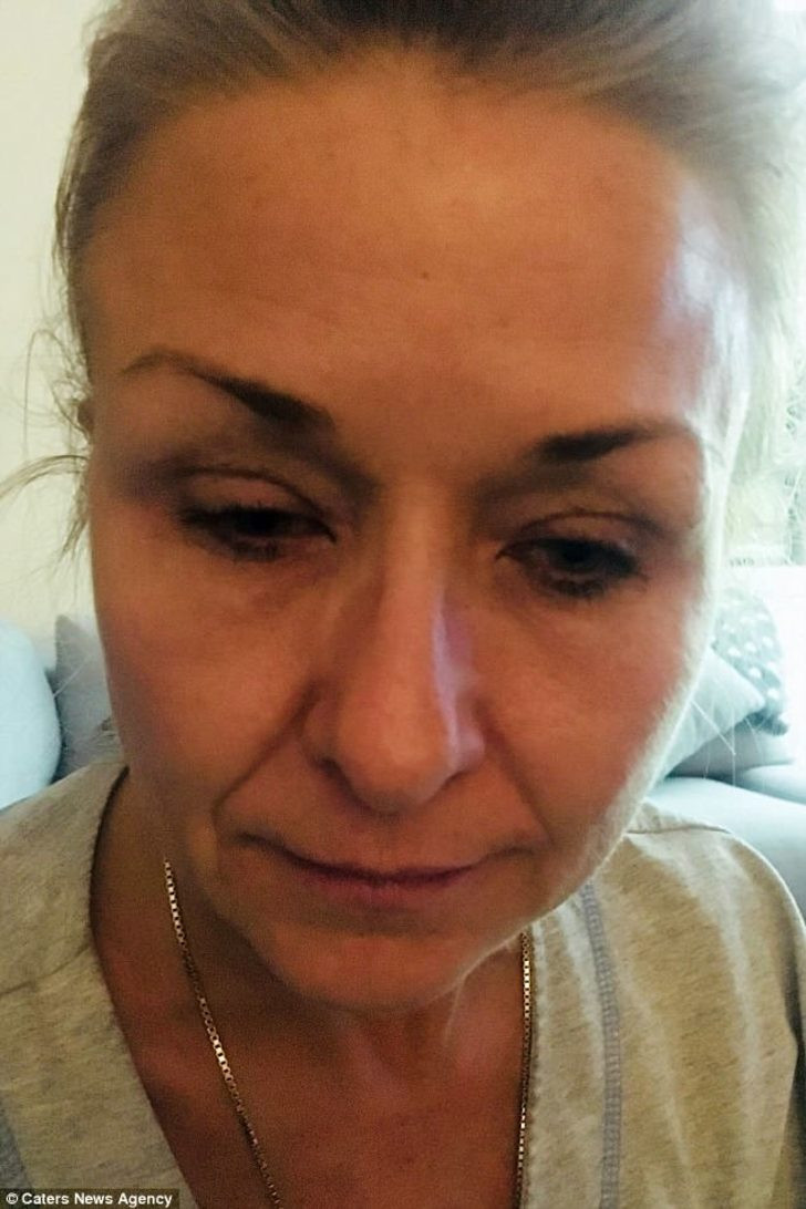 25 yıldır sürdüğü rimeli temizlemeyince az kalsın kör oluyordu - Resim: 3