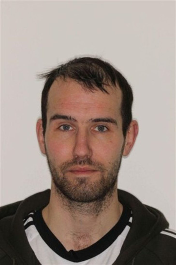 Günde 6 litre kola onu öyle bir hale getirdi ki.. - Resim: 4