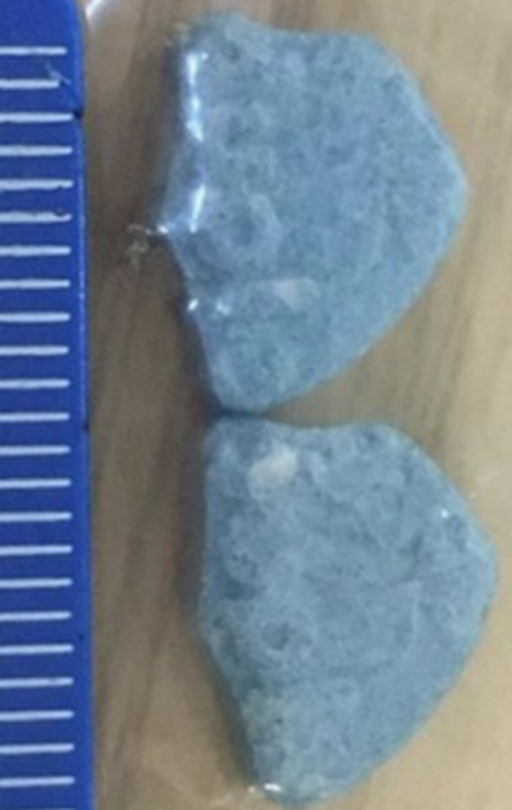 Ailesi ibret olsun diye fotoğraflarını yayınladı - Resim: 3