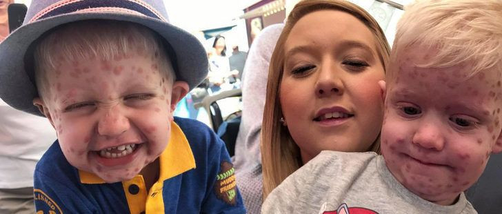 Su çiçeği çıkarıyor sandılar doktora gidince gerçek ortaya çıktı - Resim: 2