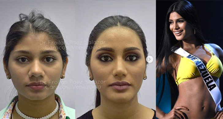 Venezuela Güzeli estetikli çıktı! Doktorundan bomba açıklama - Resim: 1