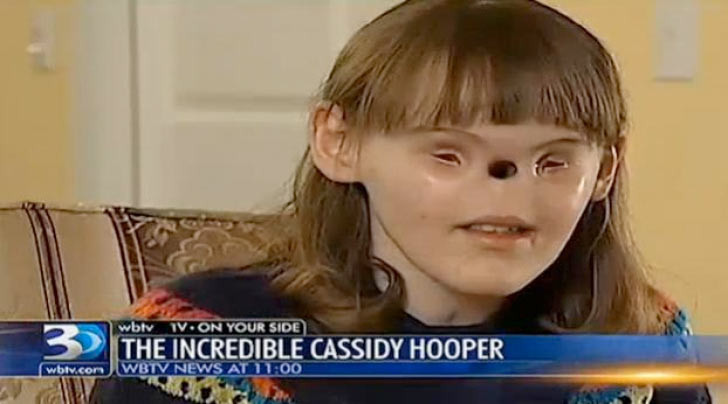 Burun ve gözü olmayan kız - Resim: 1