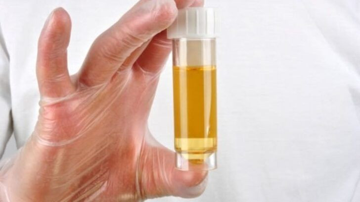 İdrardan kan gelmesi nedenleri ve tedavisi - Resim: 2