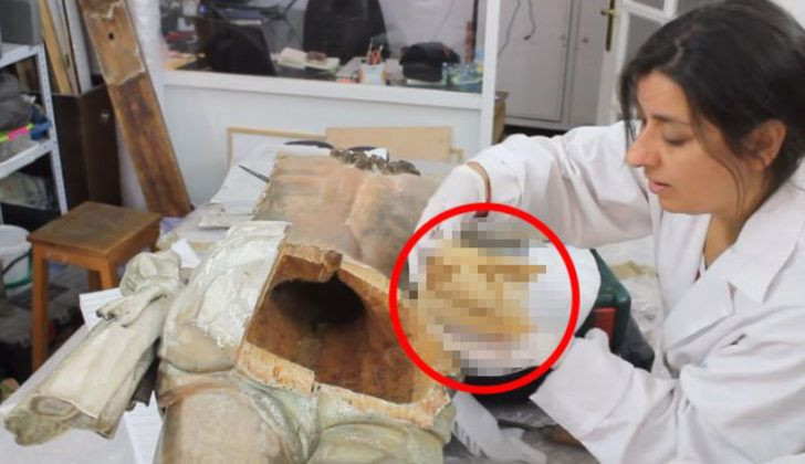 Kalçasından çıkana uzmanlar bile şaşırdı! - Resim: 1