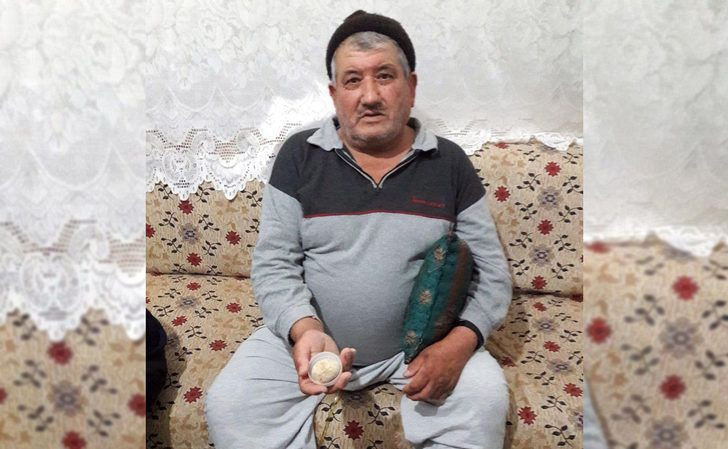 Mesanesinden çıkan doktorları bile şoke etti! Tam 300 gr ve... - Resim: 2